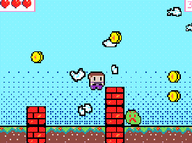 micro:bit arcade game case: Jumpy Platformer